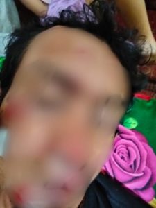 Usai Kecelakaan, Terjadi Pengeroyokan dan Pengancaman di SPBU Codo