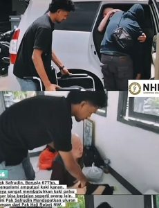 Safrudin Kembali Bisa Berjalan Berkat Bantuan Kaki Palsu dari Haji Robert