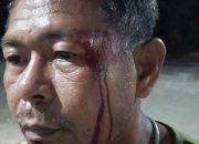 Pelipis Pecah Hingga Berdarah, Korban Pertanyakan Keseriusan Polsek Gane Timur Tangani Laporan
