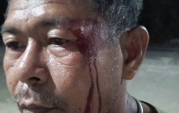 Pelipis Pecah Hingga Berdarah, Korban Pertanyakan Keseriusan Polsek Gane Timur Tangani Laporan