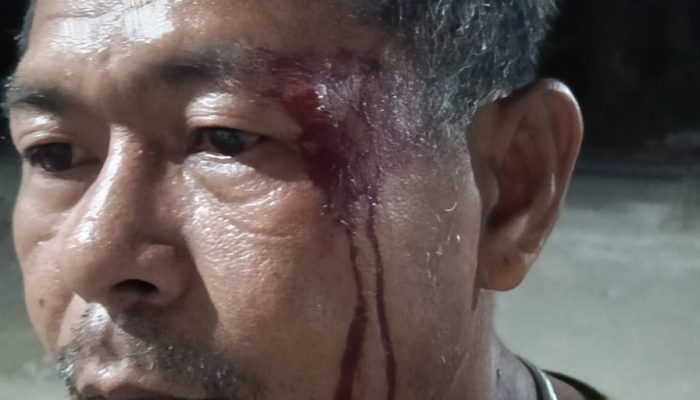 Pelipis Pecah Hingga Berdarah, Korban Pertanyakan Keseriusan Polsek Gane Timur Tangani Laporan